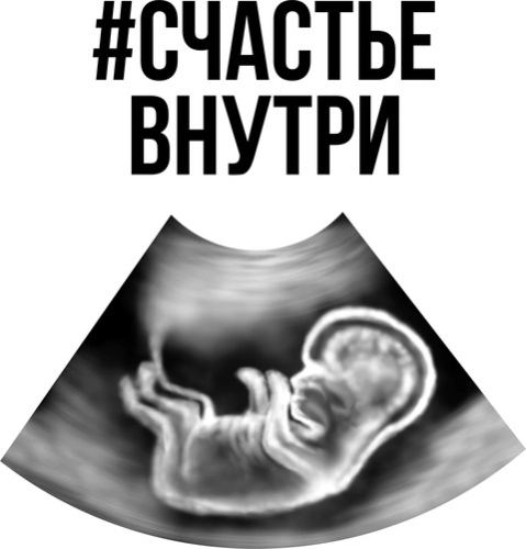 Беременные_19